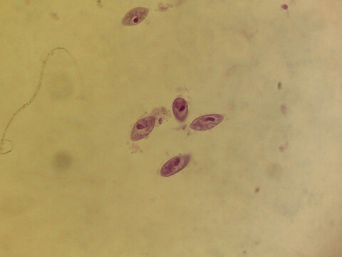 Paramecium caudatum Binary Fission Stages Showing Transverse Cell Division Pr