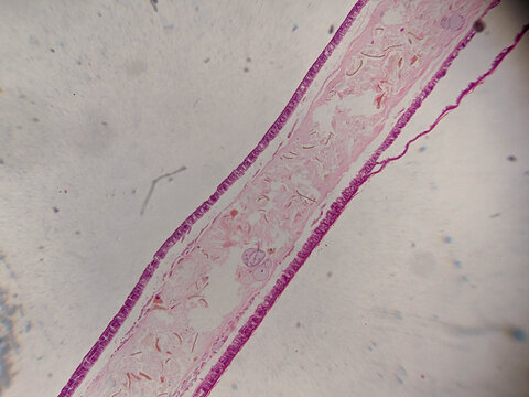 Gregarina Sporozoan Parasite Whole Mount Showing Trophozoite in Insect Intes