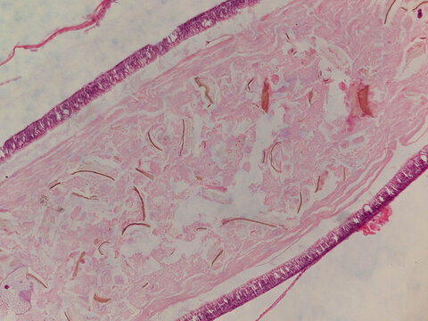Gregarina Sporozoan Parasite Whole Mount Showing Trophozoite in Insect Intes