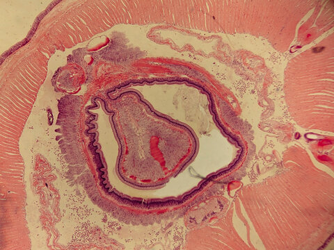 Earthworm Seta Cross Section Showing Follicle Structure and Surrounding Muscula