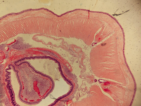 Earthworm Seta Cross Section Showing Follicle Structure and Surrounding Muscula
