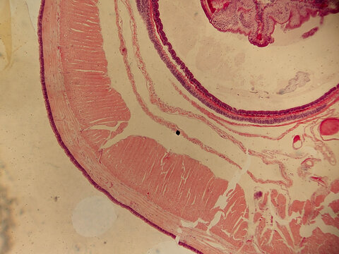 Earthworm Seta Cross Section Showing Follicle Structure and Surrounding Muscula