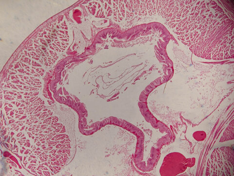Earthworm Seta Cross Section Showing Follicle Structure and Surrounding Muscula
