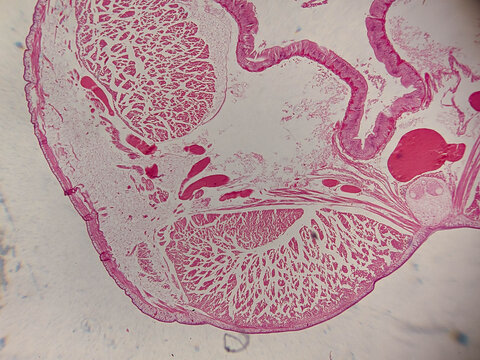 Earthworm Seta Cross Section Showing Follicle Structure and Surrounding Muscula