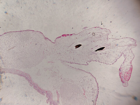 Nereis Polychaete Cross Section Showing Parapodium and Body Wall La
