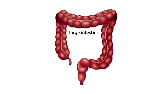 Animation showing progression of colon cancer from polyps to lymph nodes and liver metastasis.