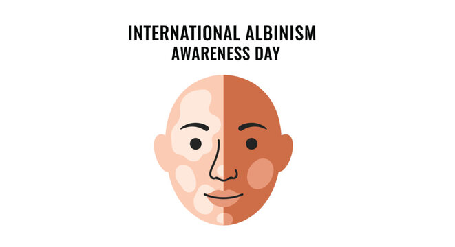 Flat vector illustration design representing international albinism awareness day with a split human face graphic