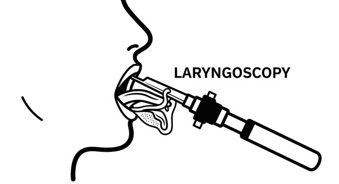 Laryngoscopy medical procedure illustration, black and white line art.