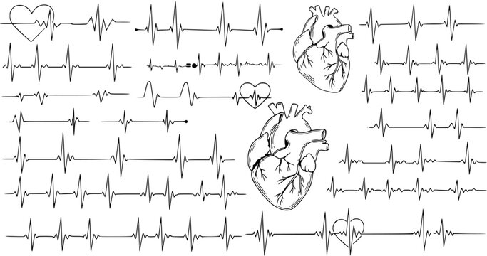 Heart Rhythm: ECG Lines  Anatomical Heart Drawings - Medical Science Art