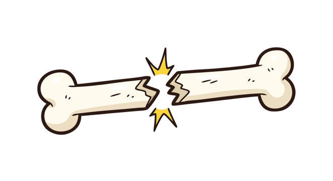 A cartoon illustration depicts a fractured bone with visible cracks and starburst effects high quality