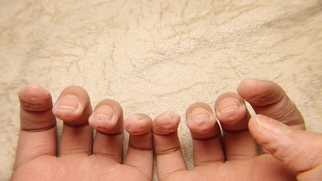 Wrinkled fingertips after prolonged water exposure, highlighting skin texture, hydration effects, and human physiology. Ideal for medical, dermatology, hygiene, and health education concepts.