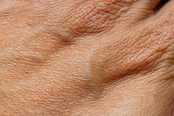 Naklejka premium Extreme Macro Texture of Human Skin Surface,High-detail macro shot showing the complex texture, High-detail macro shot showing the complex texture, pores, and natural patterns of human skin, highlight