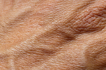 Naklejka premium Extreme Macro Texture of Human Skin Surface,High-detail macro shot showing the complex texture, High-detail macro shot showing the complex texture, pores, and natural patterns of human skin, highlight