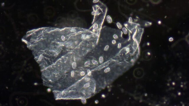 Numerous small young ciliates move in a transparent scale under the magnification of a microscope.