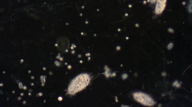 Fast ciliates move against a dark background in liquid among small protozoa.