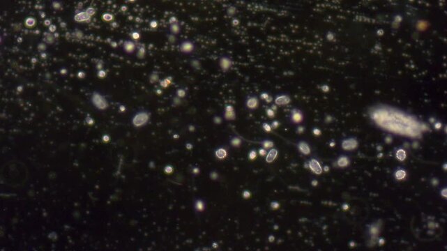 A multitude of single-celled protozoa move in liquid against a dark background.