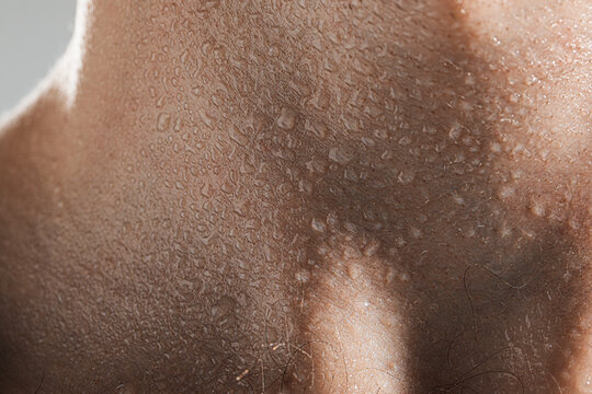 Man suffering from sweating on grey background, closeup