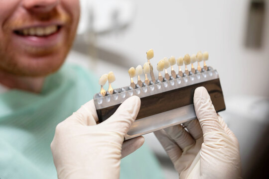 Dentist choosing tooth color using a dental shade guide for a patient
