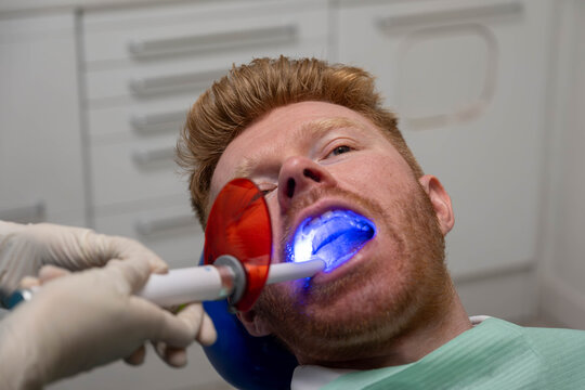 Patient undergoing dental procedure with UV light device at modern clinic