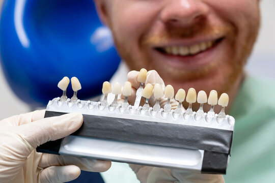Dentist matching tooth shade for patient choosing dental veneers