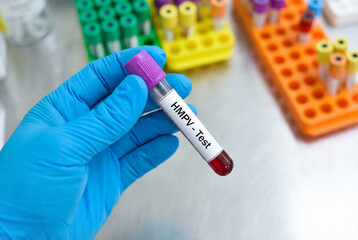Fototapeta premium Scientist gloved hand holding a test tube labeled HMPV test for virus detection