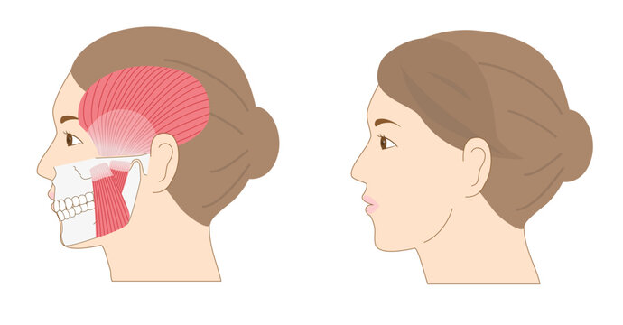 女性の横顔と下顎（あご）の骨と筋肉を重ね合わせた解剖学イラスト比較セット