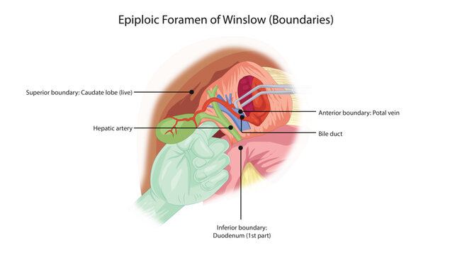 Epiploic Foramen (Foramen of Winslow) &ndash; Boundaries
anatomical boundaries of the epiploic foramen including portal triad and surrounding structures.