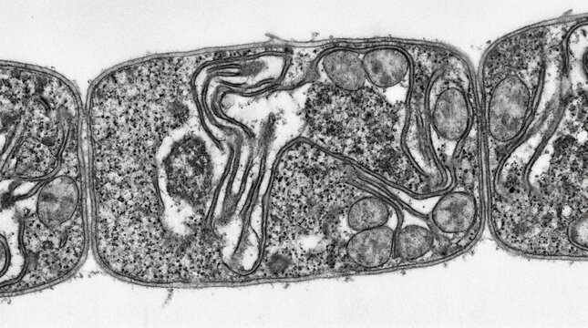 Endosome-Lysosome Fusion Event in Dendrite