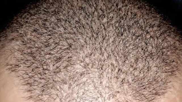 Close up of short dark hair on a person's head.