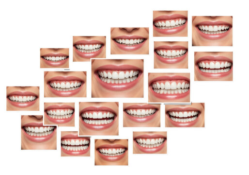 Ultra close-up mosaic of multi-ethnic human mouths showing perfect white teeth and pink gums, razor-sharp digital snippets against a shadowless transparent background with copy space. Aesthetic