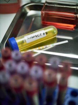 Various analyses of urine, saliva and blood of homicide suspects in crime lab, conceptual image.