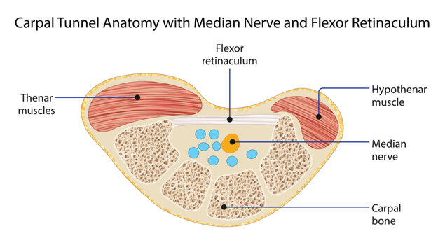 Carpal Tunnel Anatomy with Median Nerve and Flexor Retinaculum
Cross-sectional illustration of the wrist showing the carpal tunnel, median nerve, flexor retinaculum, and surrounding structures.
