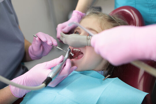Superficial sedation during dental treatment in child. Little girl in dentist's office. Treatment of children's teeth with nitrous oxide. Treatment of baby teeth.