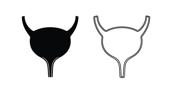 Anatomical illustration of the human urinary bladder solid and outline views