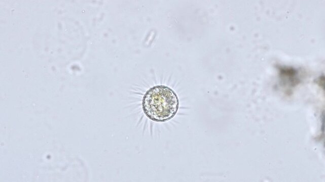 Ciliate microorganism rotating under microscope, aquatic micro life in water sample