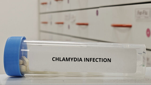 CHLAMYDIA INFECTION treatment tablets used to eliminate bacterial infection caused by chlamydia trachomatis