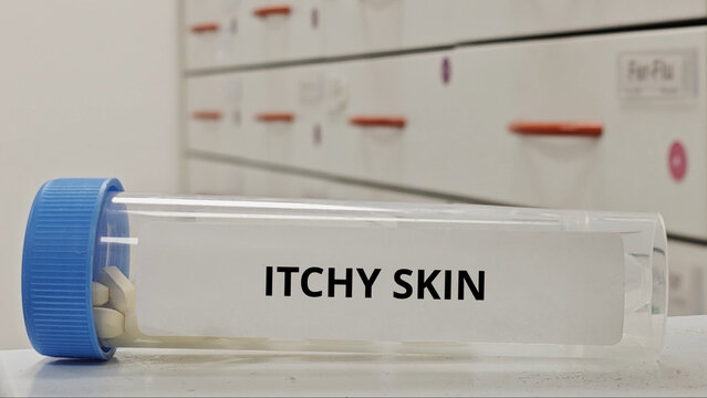 ITCHY SKIN treatment tablets for relieve pruritus and reduce skin irritation