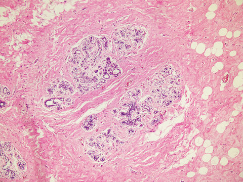 The mammary gland consists of mammary lobes; each lobe is an independent secretory gland, with a lactiferous duct leading to a pore at the nipple on the body surface. Magnify 40x
