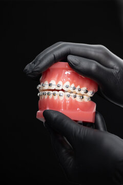 Doctor orthodontist holding and demonstrating anatomical model of human jaw with metal wire braces brackets attached for orthodontic treatment education and patient consultation