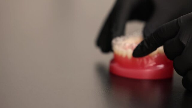 Dental aligners placement on jaw model orthodontic demonstration