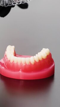 Clear dental aligners placement on jaw model training demonstration