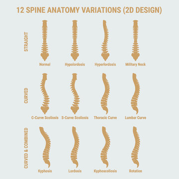 Comprehensive medical diagram illustrating diverse human spinal column variations, highlighting normal, curved, and combined postural deviations for health and wellness education