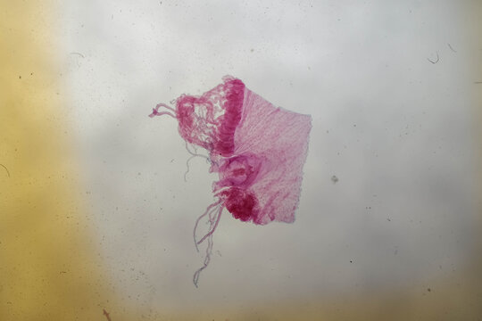 Stained Aurelia Medusa Tentaculocyst Margin Microscope Sli