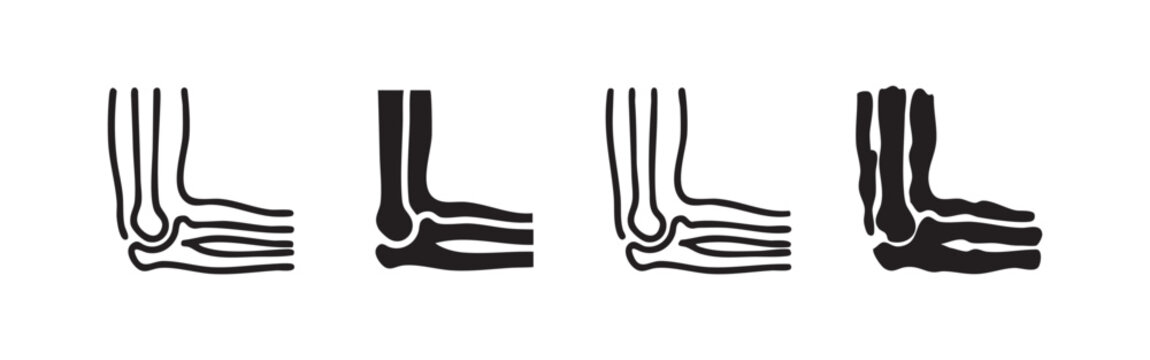 Human Elbow Joint Anatomy Icons Set Hand Drawn Style