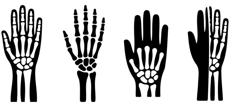Collection of black hand skeleton x ray icons for medical design