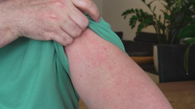 Close-up of an adult person showing a fresh adhesive bandage on the upper arm after receiving a vaccine shot. Real life healthcare concept of seasonal vaccination. 