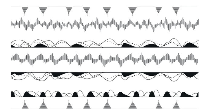 Electrocardiogram ecg waveforms diverse heart rhythm patterns displayed