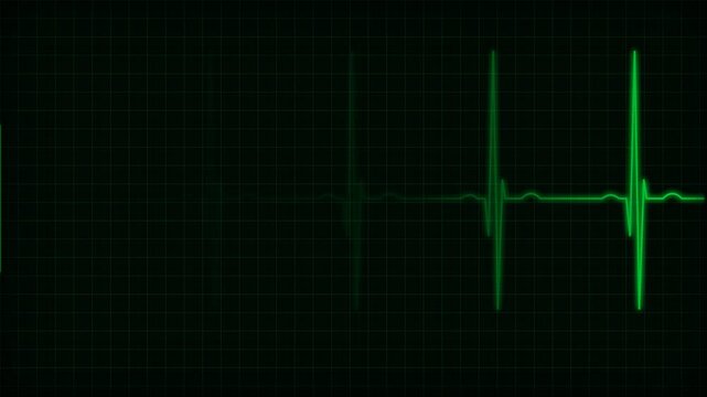 Green Glowing Medical EKG Heart Rate Monitor on Dark Grid Background