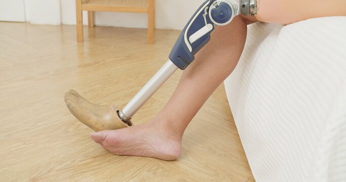 An amputee with a modern prosthetic leg rests at home, showcasing independent living with a disability and the integration of advanced medical technology.