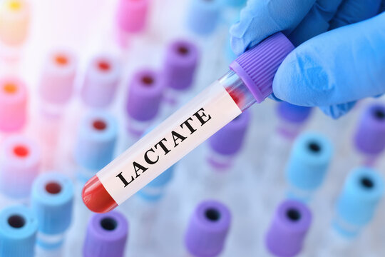 Doctor holding blood sample tube with lactate test in modern medical laboratory, biochemical blood analysis concept for diagnostics of metabolism, hypoxia, acidosis and emergency healthcare monitoring